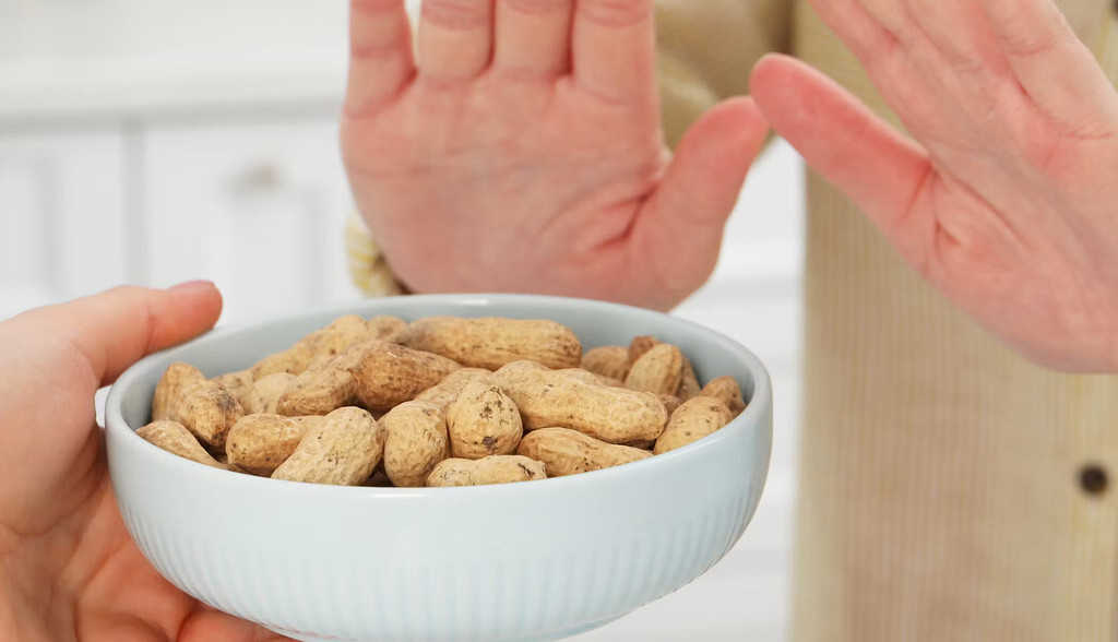 Claves de la alergia al cacahuete y últimos avances en su tratamiento