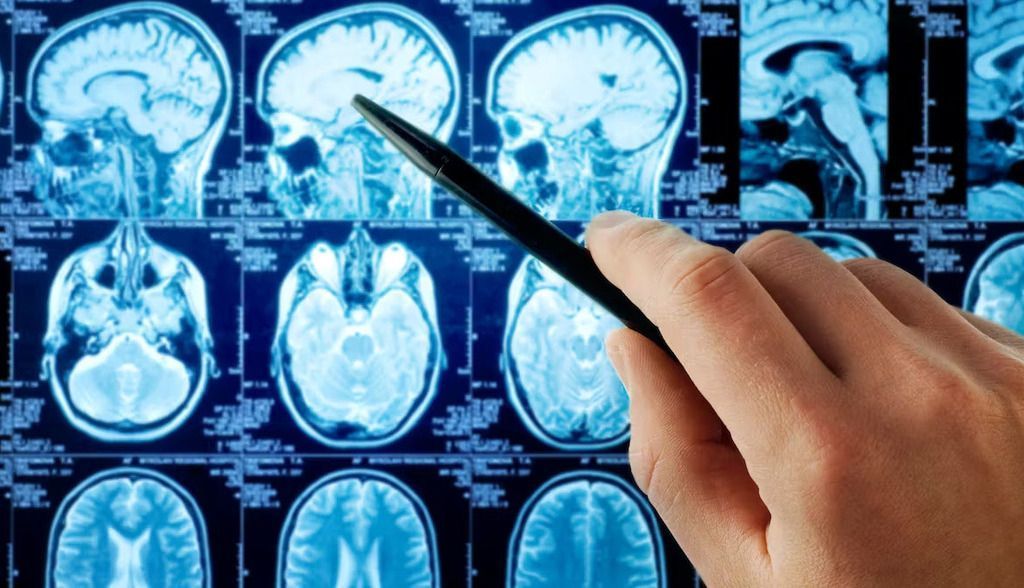 ¿Existe algún método científico para averiguar la edad de nuestro cerebro?