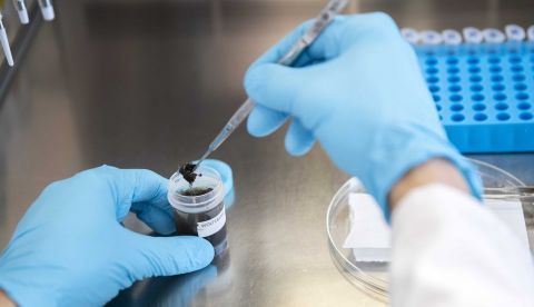 Investigadores del Instituto de Neurociencias de la Universidad de Barcelona (UBNeuro) han descubierto que los astrocitos, un tipo de células del cerebro, liberan proteínas que favorecen la supervivencia de las neuronas, lo que abre nuevas posibilidades terapéuticas contra el alzéhimer.EFE/Archivo 	   