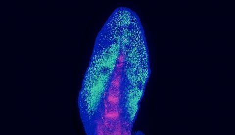 Una aleta embrionaria del pez pulmonado australiano, tal como se utilizó en el estudio. La aleta se ha teñido con marcadores fluorescentes para visualizar el esqueleto interno en desarrollo (rojo), a partir del cual evolucionaron las extremidades de los animales terrestres, y la posición del esqueleto externo (verde) que es específico de los peces. EFE/Joost Woltering/Universidad de Konstanz.