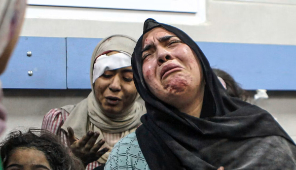 Palestinos heridos en el hospital Al-Shifa, tras los ataques aéreos israelíes en la ciudad de Gaza, 17 de octubre de 2023. Abed Khaled/AAP