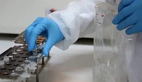 Identifican cómo evitar un exceso de actividad del tejido que quema calorías/EFE/EPA/ORESTIS PANAGIOTOU