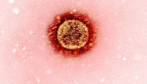 Micrografía de una partícula del virus del SARS-CoV-2 (variante UK B.1.1.7), aislada de una muestra de un paciente y cultivada en una célula. NIAID / Flickr, CC BY-SA