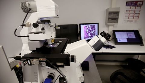 Investigadores de la Universidad de Ginebra han descubierto que algunos linfocitos T con un receptor específico,  permiten reducir el tamaño de tumores, informó hoy la institución académica. EFE/Archivo