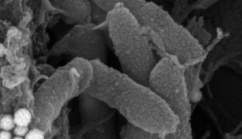 Imagen de la bacteria "Pseudomonas aeruginosa" vista a través de un microscopio. EFE/Cedida por el Consejo Superior de Investigaciones Científicas (CSIC)