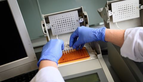 Lo que hace la mutación D614G es incrementar hasta 4 ó 5 veces el número o la densidad de "espigas" funcionales existentes en la superficie viral y a la vez hacerlas más flexibles. EFE/Fernando Villar