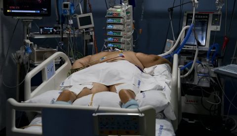 La obesidad es el segundo factor de riesgo más importante de Covid-19. Josep Lago/AFP