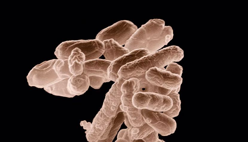 Micrografía electrónica de baja temperatura de un cúmulo de bacterias E. coli ampliado cien mil veces. Wikimedia Commons / United States Department of Agriculture
