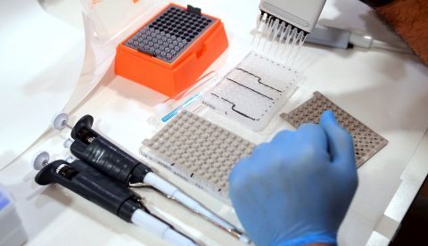 Los trabajos los han llevado a cabo científicos de un consorcio de investigadores del Centro de Investigación del Cáncer de Ontario y el Hospital for Sick Children de Toronto, el Hospital Clínic-Idibaps de Barcelona y la Universidad de Oviedo. EFE/Rafa Alcaide/Archivo 	   