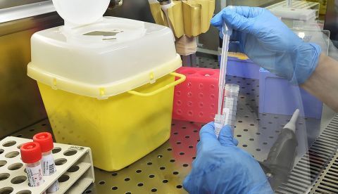 Investigan dos proteínas que podrían combatir el coronavirus. /EFE/Alessandro Di Marco/Archivo