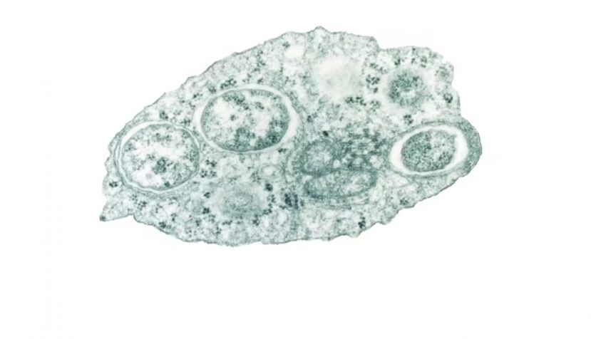 Micrografía electrónica de transmisión de Wolbachia en una célula de insecto. Wikimedia Commons / Scott O'Neill, CC BY-SA