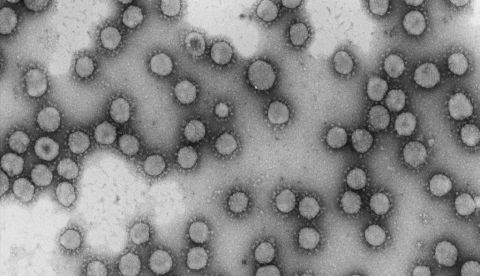 Virus de la familia Coronaviridae. EFE/Luis Enjuanes-CNB-CSIC.