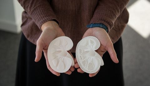 Bioingenieros plantean la creación de órganos funcionales con impresoras 3D