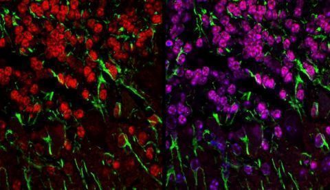 Radiografían por primera vez las enfermedades mitocondriales en España