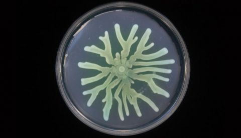 Nueva estrategia en la lucha contra los patógenos resistentes a antibióticos / EFE