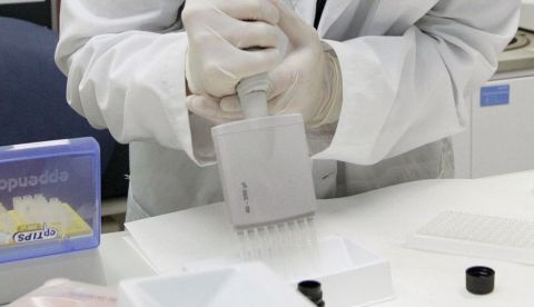 Un equipo de investigadores españoles ha identificado una molécula para el potencial tratamiento del ictus, enfermedades cerebrovasculares que engloban un conjunto de trastornos causados por la disminución del flujo sanguíneo cerebral. EFE/Archivo