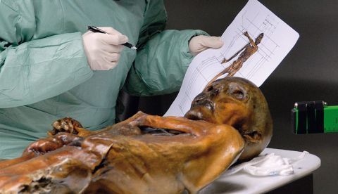Un científico examina la momia de Ötzi. © South Tyrol Museum of Archaeology/EURAC/Samadelli/Staschitz