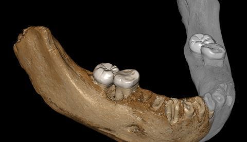 Los primeros homínidos que habitaron en el Tíbet pertenecieron a la subespecie de los denisovanos, según un estudio difundido hoy por el Instituto Max Planck para AntropologíaEvolutiva, con sede en Leipzig (este de Alemania). En la imagen, una reconstrucción de los dos lados de la mandíbula. Las partes espejadas están en gris. EFE 	   