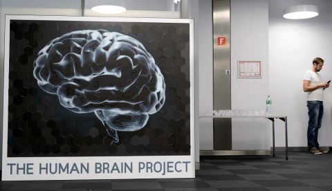 La epilepsia es un trastorno cerebral que se manifiesta en crisis resultantes de un exceso de actividad eléctrica del cerebro/EPA/LAURENT GILLIERON
