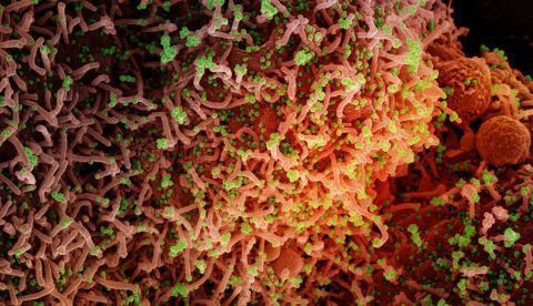 Micrografía electrónica de barrido coloreada de una célula infectada con una cepa variante del virus SARS-CoV-2 (21 de diciembre de 2021). NIAID / Flickr, CC BY-SA