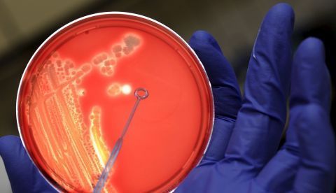 La descripción de este fármaco, probado en modelos de animal, se publica en la revista Nature Biotechnology, en un artículo que firman investigadores de la Universidad Politécnica de Madrid (UPM) y del Instituto Pasteur de París. EFE/Archivo 	   